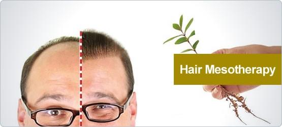 hair-mesotherapy.jpg